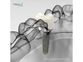 Best Dental Implant Brands in Nicaragua | 2025 Guide