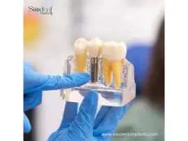 Dental Implant Wholesalers in Paraguay for Bulk Orders